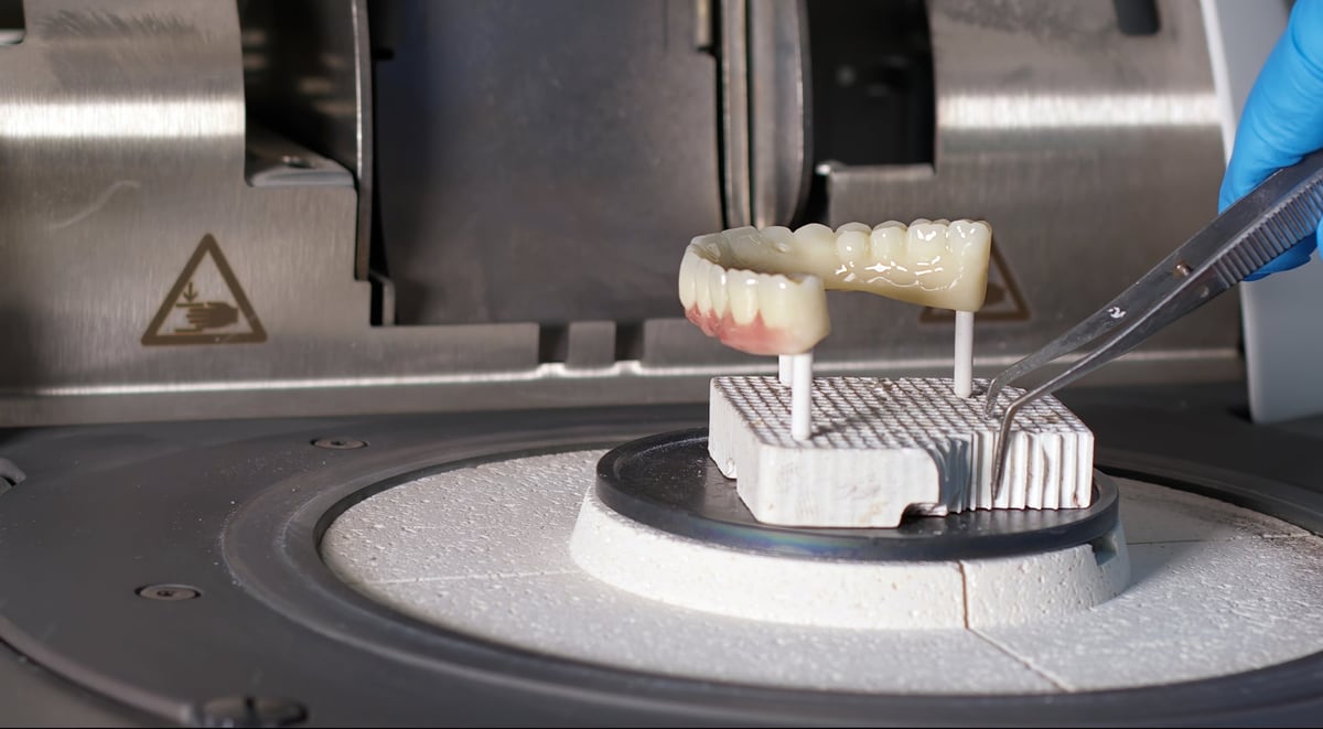 Tecnología digital de laboratorio dental