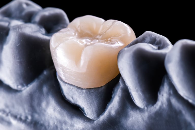 Ceramic e.max dental crowns