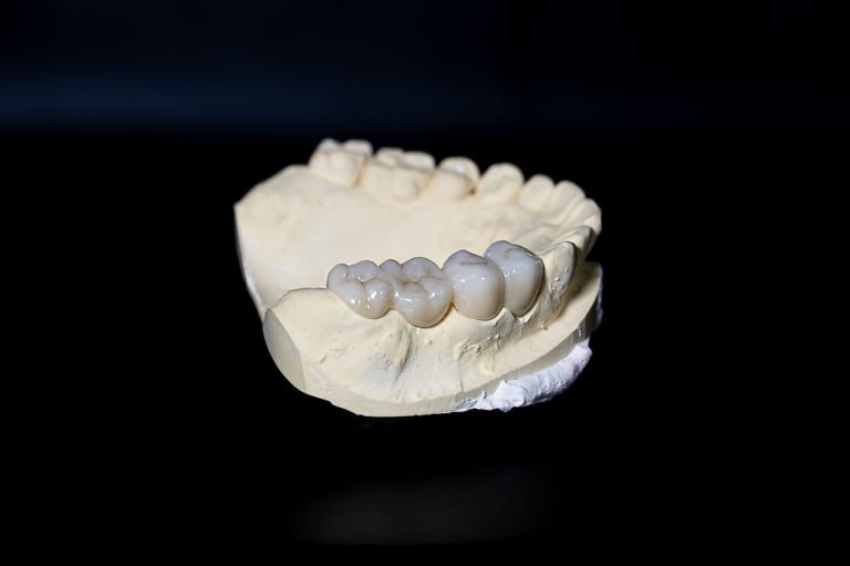 Zirconia dental crown on tooth model
