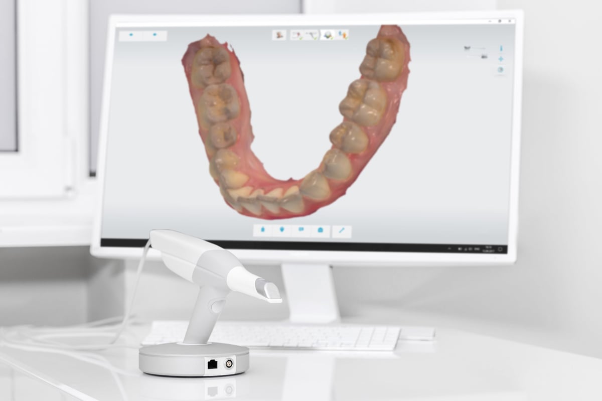 Tecnología digital de laboratorio dental